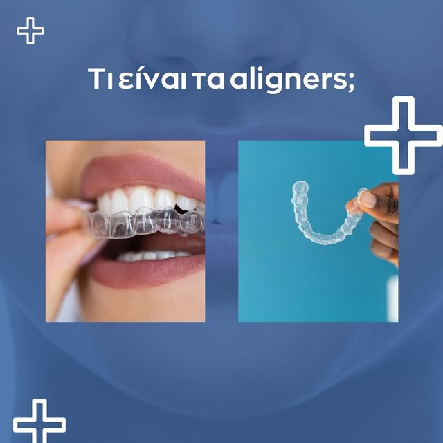Discover clear aligners