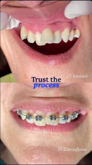Progress in practice: earlier photograph